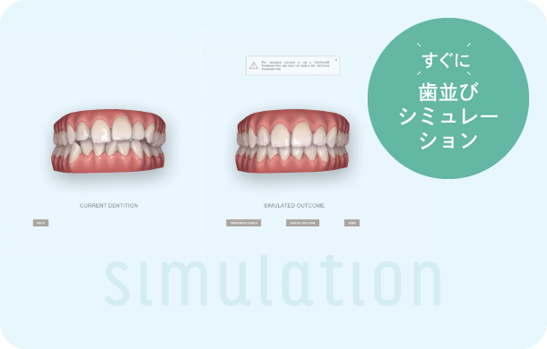 すぐに歯並びシミュレーション
